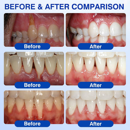 🏅🦷🛡️𝐇𝐄𝐀𝐓𝐖𝐎𝐋𝐅® GumRevive Periodontal Repair Gel