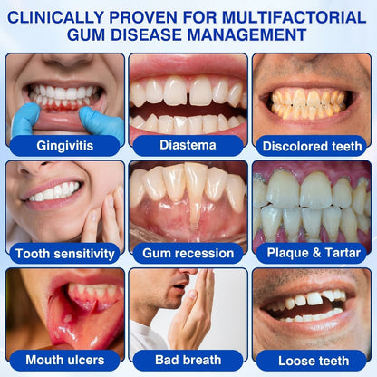 🦷🛡️𝐇𝐄𝐀𝐓𝐖𝐎𝐋𝐅® GumRevive Periodontal Repair Gel
