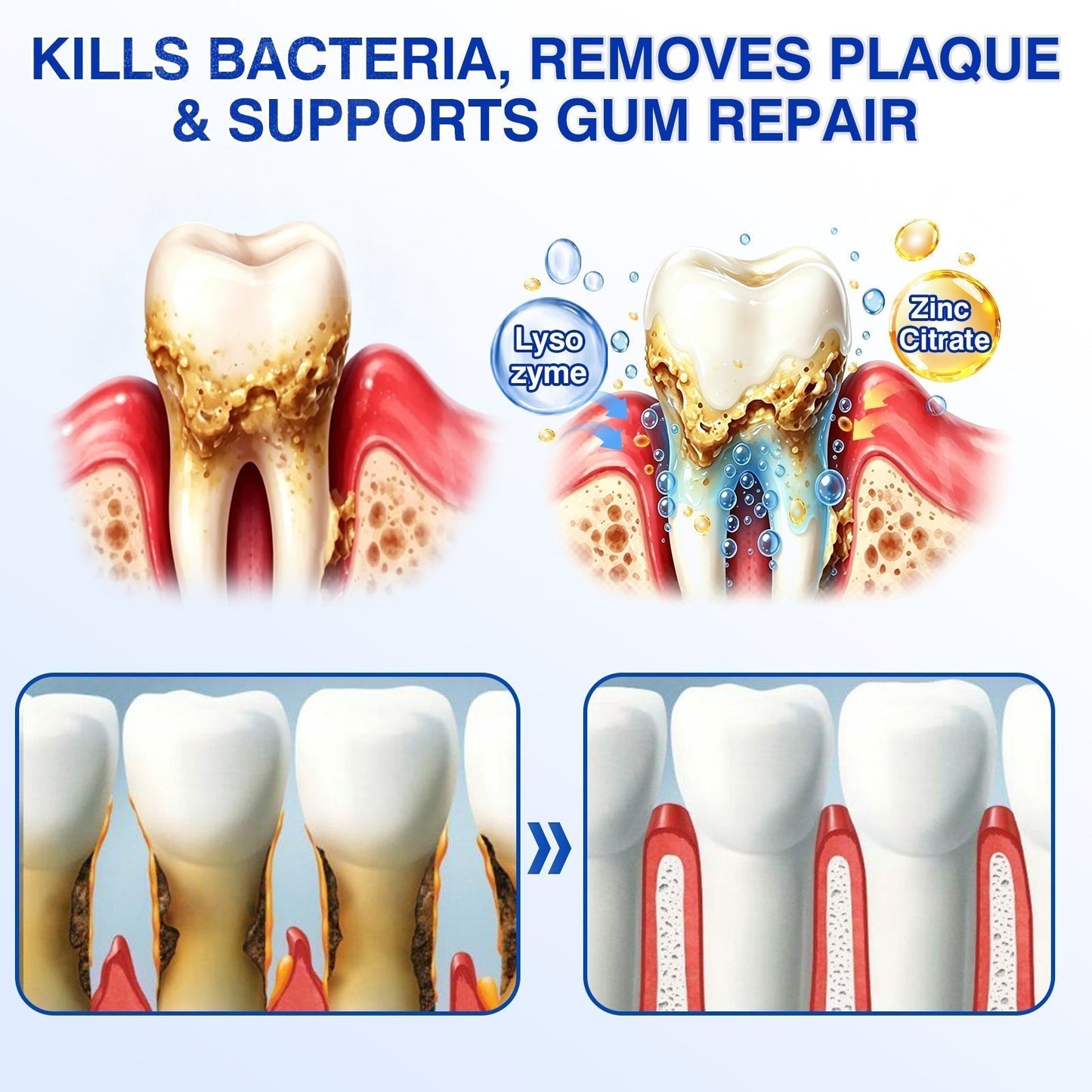 🦷🛡️𝐇𝐄𝐀𝐓𝐖𝐎𝐋𝐅® GumRevive Periodontal Repair Gel