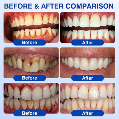 🦷🛡️𝐇𝐄𝐀𝐓𝐖𝐎𝐋𝐅® GumRevive Periodontal Repair Gel