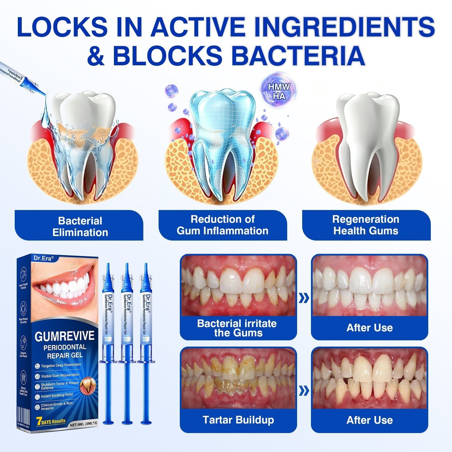 🏅🦷🛡️𝐇𝐄𝐀𝐓𝐖𝐎𝐋𝐅® GumRevive Periodontal Repair Gel