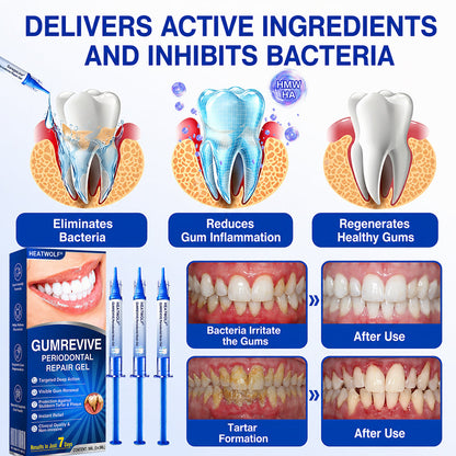🦷🛡️𝐇𝐄𝐀𝐓𝐖𝐎𝐋𝐅® GumRevive Periodontal Repair Gel